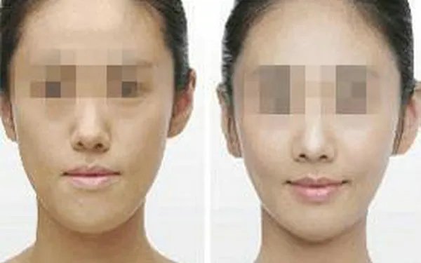 黑脸娃娃效果图片对比