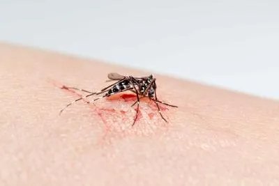 被蚊子咬了肿很大如何消肿