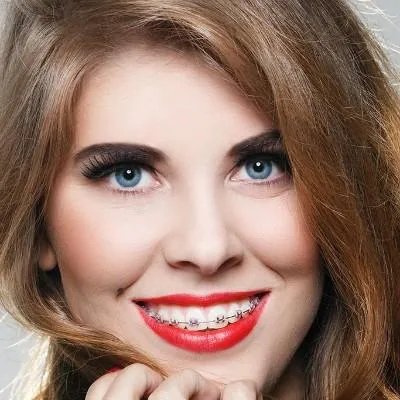 遗传斑如何去除