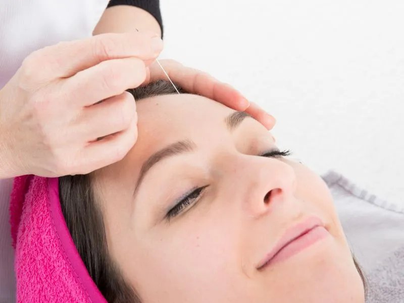 什么是像素激光除皱