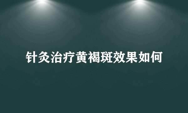 针灸治疗黄褐斑效果如何