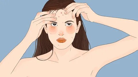 痔疮膏能治痘痘吗