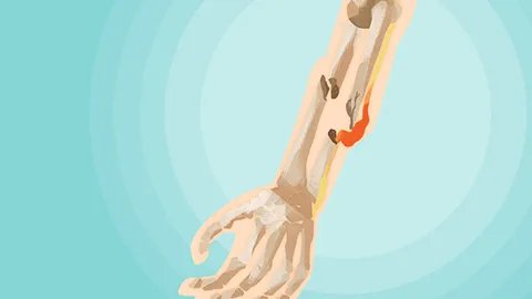 骨骼响是什么原因