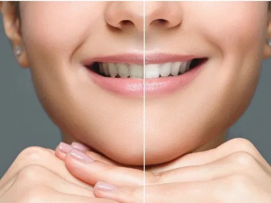 全身美白手术的优点