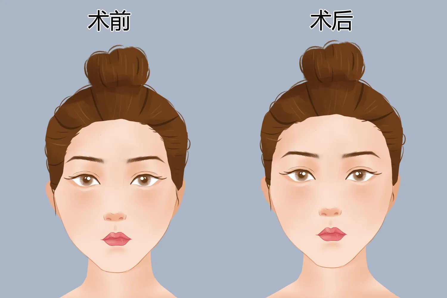 面部整形部位图解