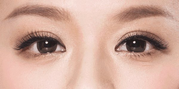 开眼角手术过程是怎样的？