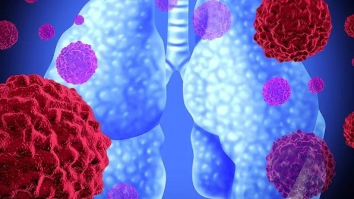 德尔塔冠状病毒症状早期表现是怎样的 德尔塔冠状病毒症状能治好吗